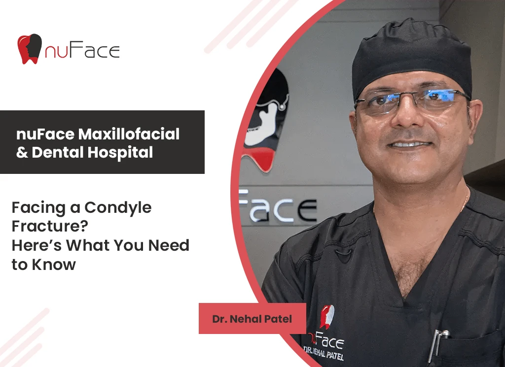 Condyle Fracture | Orthodontic surgery by Best Oral and maxillofacial Surgeon